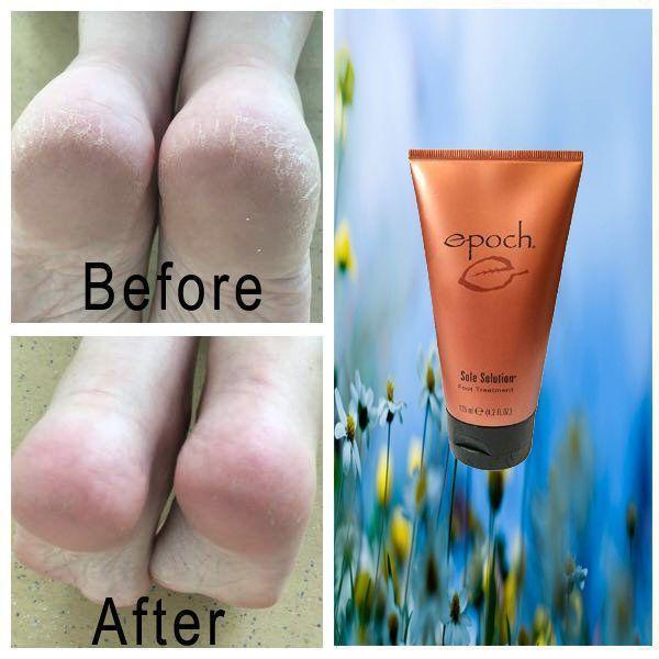 Hazel Blues® | Nu Skin Epoch® Sole Solution® Foot Treatment - Hazel Blues®